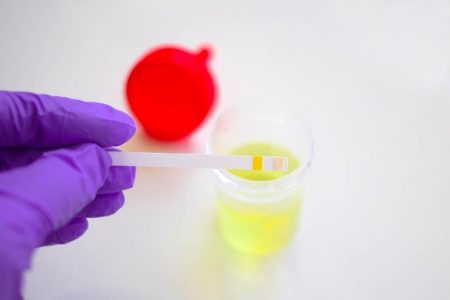 Protein in Urine During Pregnancy