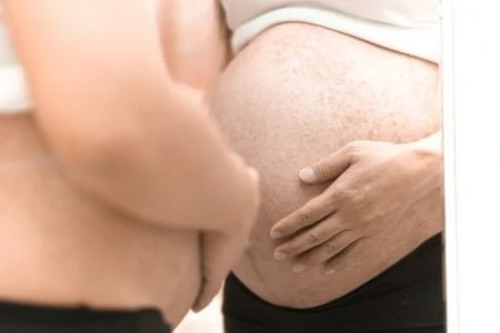 Pregnant woman with itchy rashes on her belly