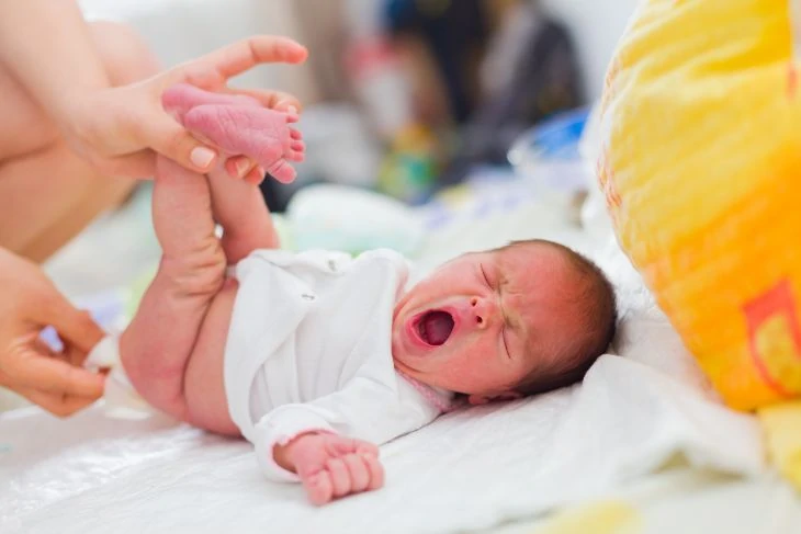 Baby with diaper rash crying while having diaper changed